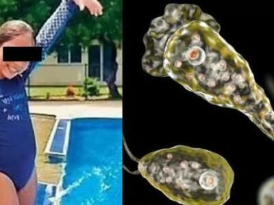 Niña de 10 años muere por infección de ameba "comecerebros" tras nadar en piscina