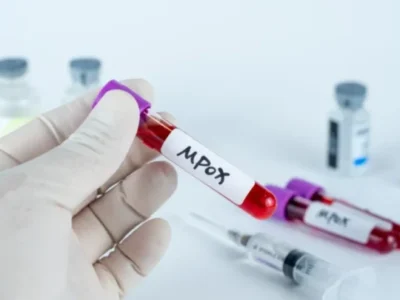 Mpox: La nueva cepa que amenaza con expandirse globalmente