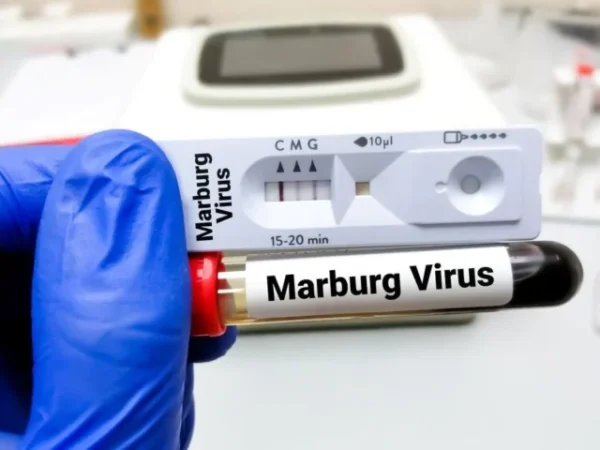 ¿Qué es el virus de Marburgo y por qué es tan peligroso?