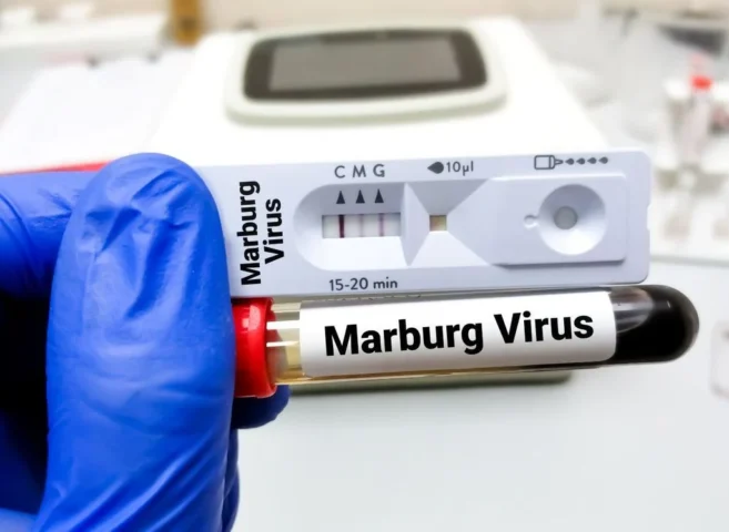 ¿Qué es el virus de Marburgo y por qué es tan peligroso?