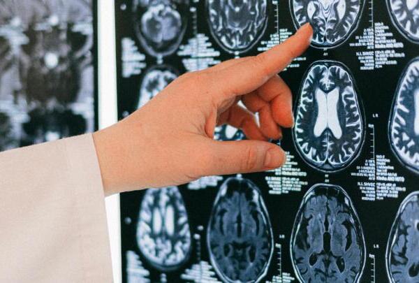 ¿A qué edad empieza a envejecer el cerebro? Esto dice la ciencia