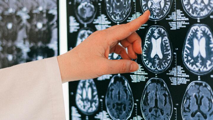 ¿A qué edad empieza a envejecer el cerebro? Esto dice la ciencia ¿A qué edad empieza a envejecer el cerebro? Esto dice la ciencia