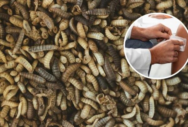 Larvaterapia, una técnica centenaria que ayuda a combatir infecciones graves