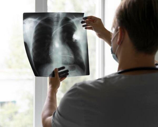 EPOC: el daño pulmonar que progresa en silencio