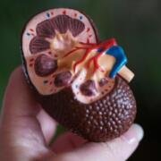 ¿Cómo cuidar tus riñones si tomas ibuprofeno con frecuencia?