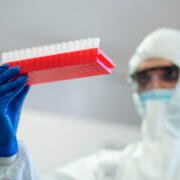 OMS advierte sobre una etapa “peligrosa” tras brotes de hantavirus y ébola