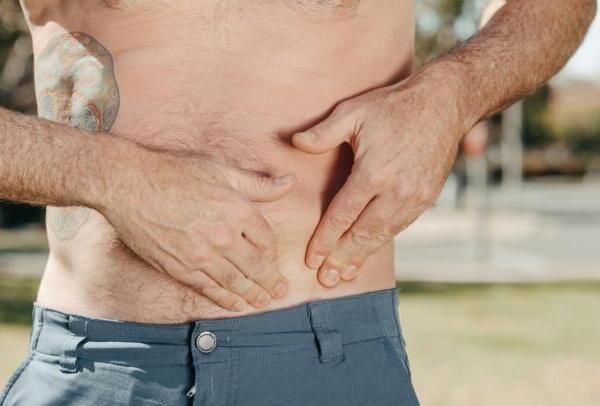 Hernias: cómo aparecen y cuándo requieren atención médica