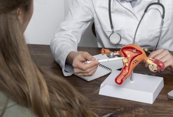 Menstruaciones irregulares podrían ser señal de ovario poliquístico