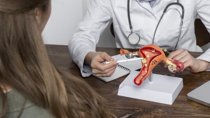 Menstruaciones irregulares podrían ser señal de ovario poliquístico