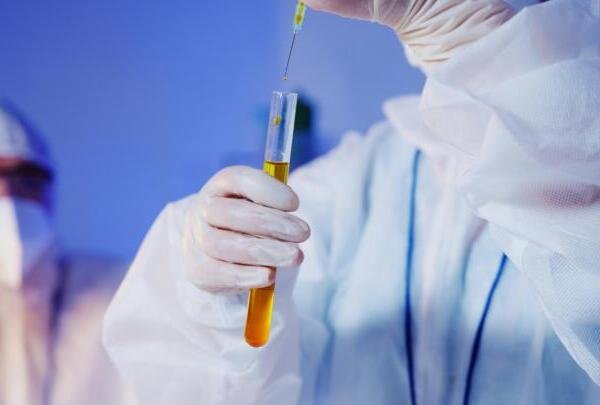 Estudio sugiere que una prueba de orina podría detectar señales de autismo en niños