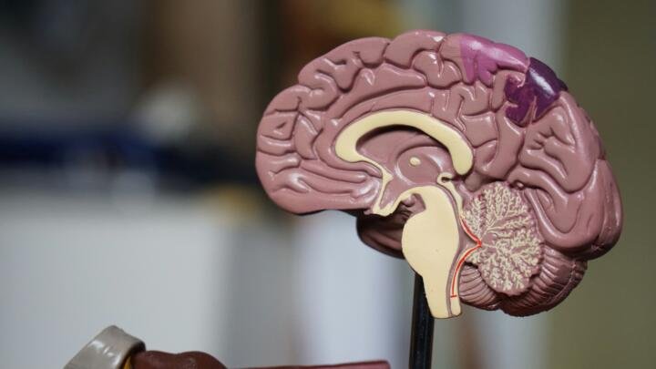 La enfermedad de Alzheimer podría comenzar décadas antes de los primeros síntomas