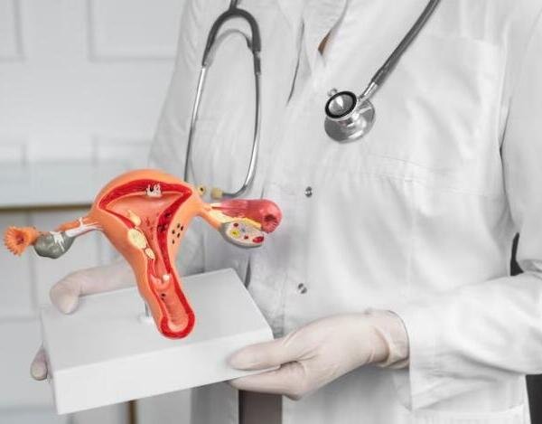 El cáncer de ovario puede pasar desapercibido hasta etapas avanzadas