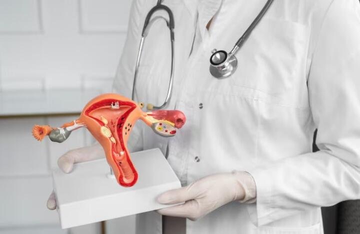 El cáncer de ovario puede pasar desapercibido hasta etapas avanzadas