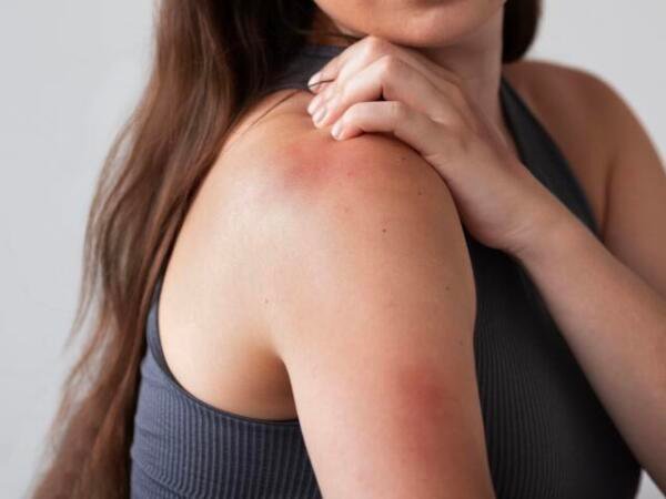 ¿Qué es la hemofilia y cuáles son sus principales síntomas?
