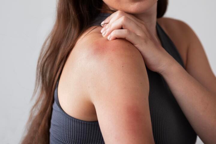 ¿Qué es la hemofilia y cuáles son sus principales síntomas?