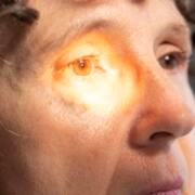 El desprendimiento de retina puede comenzar con destellos de luz y manchas en la visión
