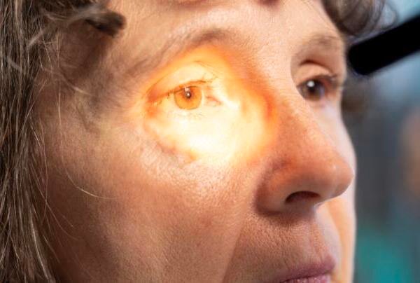 El desprendimiento de retina puede comenzar con destellos de luz y manchas en la visión