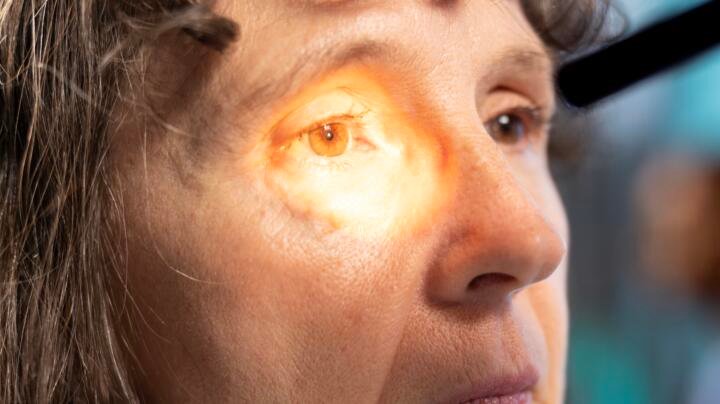 El desprendimiento de retina puede comenzar con destellos de luz y manchas en la visión