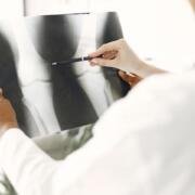 Osteoporosis: las señales que pueden aparecer antes de sufrir una fractura
