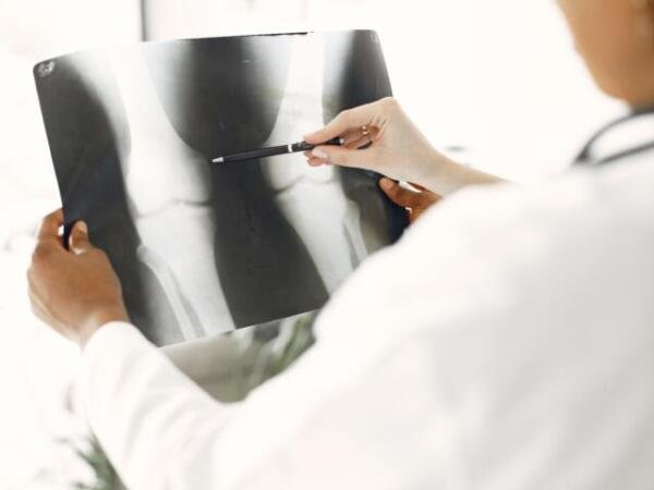 Osteoporosis: las señales que pueden aparecer antes de sufrir una fractura