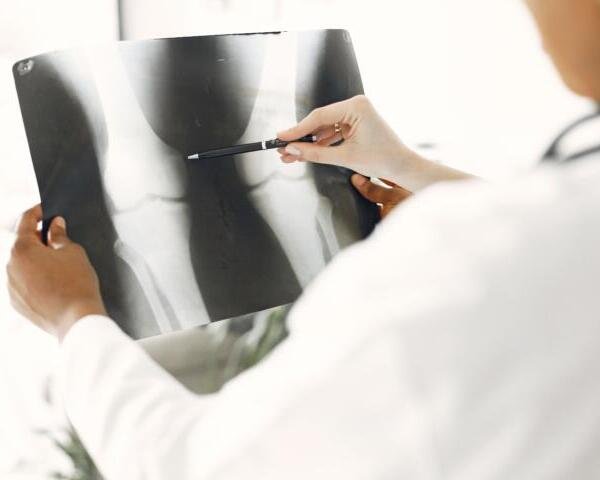 Osteoporosis: las señales que pueden aparecer antes de sufrir una fractura
